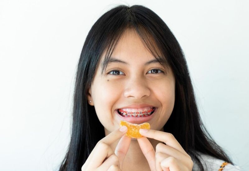 30 tuổi có nên niềng răng hay không? Giải đáp từ chuyên gia - Nha khoa Đại Nam