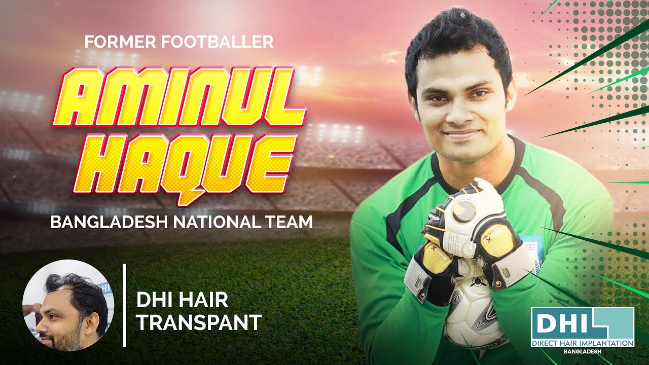 DHI Hair Transplant Of Former Bangladeshi Footballer Aminul Haque | Hair Transplant In Dhaka | DHI - YouTube