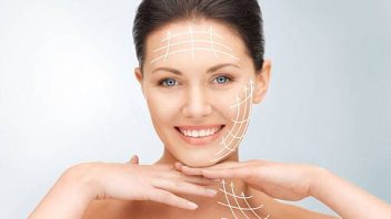 căng chỉ collagen bao lâu thì hết sưng