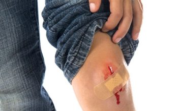 chăm sóc vết thương lên da non